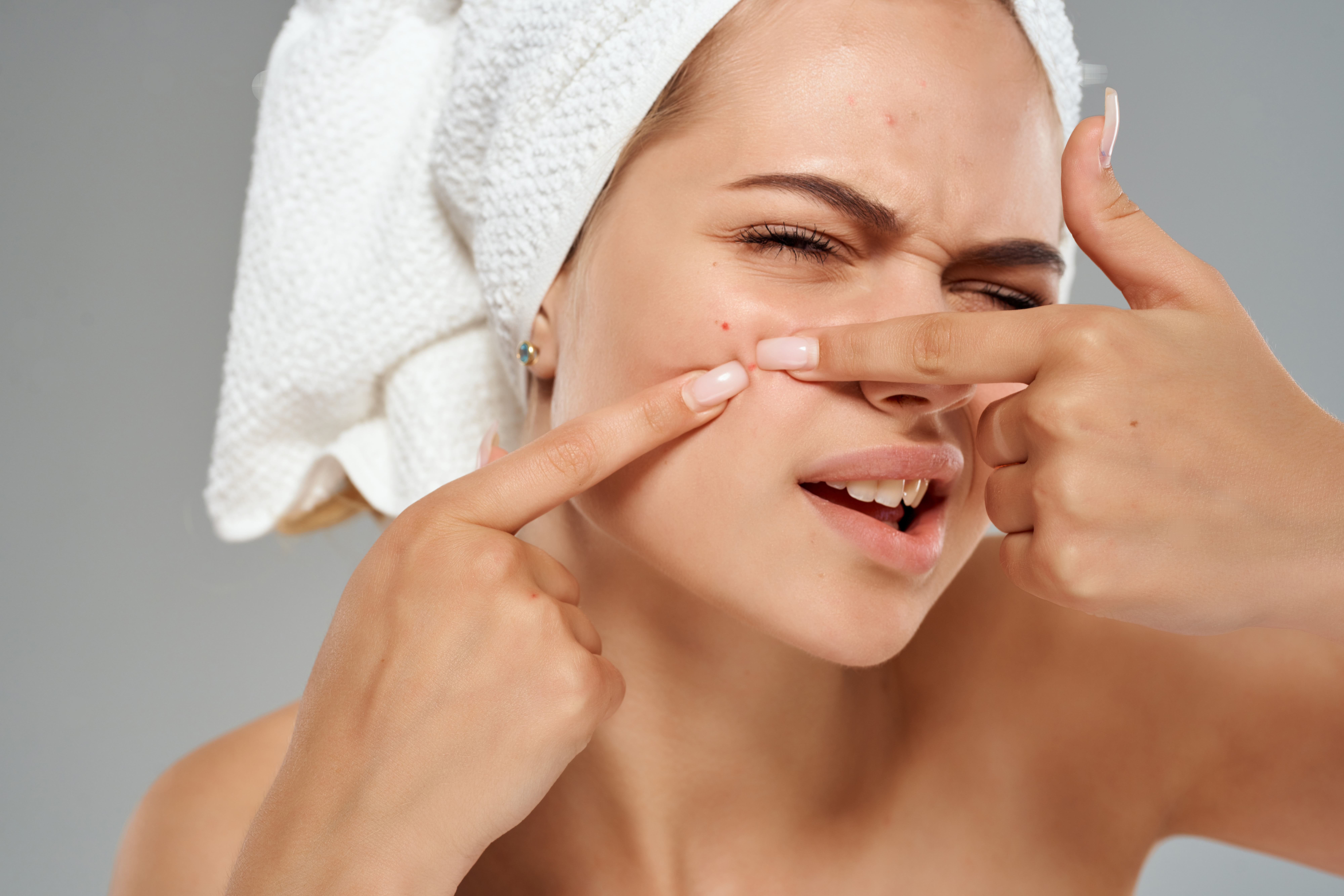 Acne Care Plus Image 3